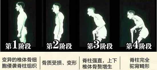 ֣ʹʪҽԺǿֱԼ׳ʹ֢״ӣɹؽڱΣмΣ.jpg