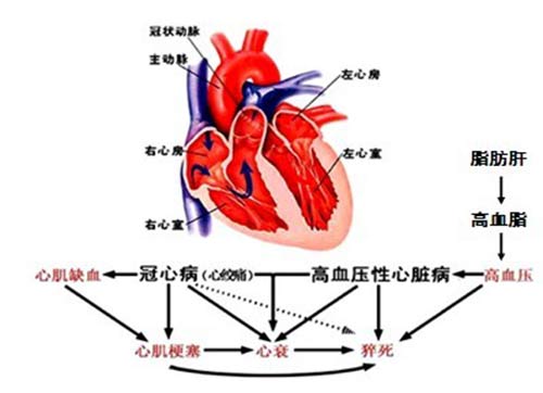 郑州痛风风湿病医院高尿酸血症会引发的疾病.jpg