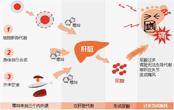 郑州痛风风湿病医院痛风形成原理.jpg